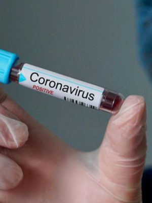 20200310113144_860_645_-_laboratorio_busca_voluntarios_para_testar_vacina_de_coronavirus